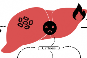 Effetcs alcohol liver