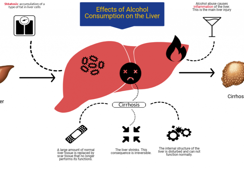 Effetcs alcohol liver